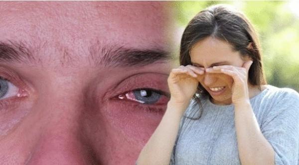 عوامل و أسباب تؤدي إلى احمرار العينين