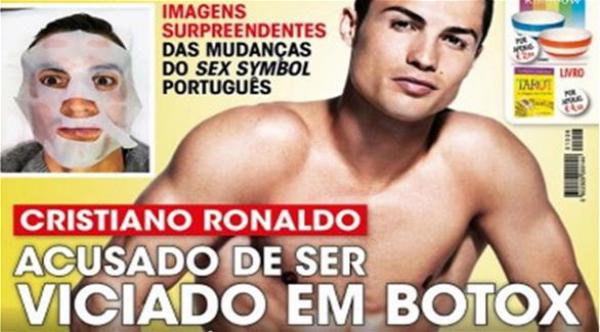 مجلة برتغالية : كريستيانو رونالدو مدمن على &quot;البُوتوكس&quot;