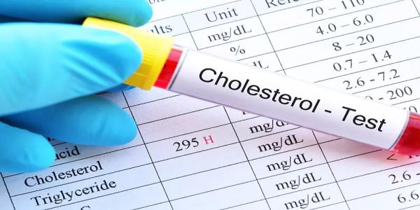 باحثون أمريكيون يطورون لقاحا يمكنه خفض نسبة الكوليسترول الضار
