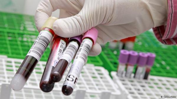 باحثون يطورون تحليلا للدم يتنبأ بعمر الإنسان