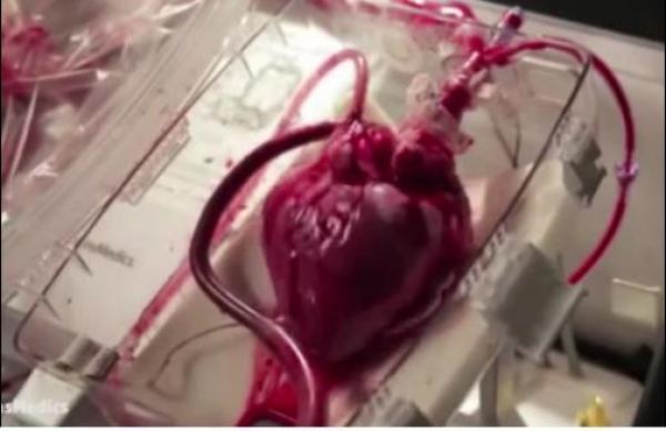 بالفيديو: قلب طبيعي ينبض للمرة الأولى خارج الجسم البشري