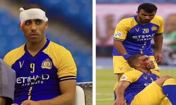 إصابة دامية لـ"حمدالله" في مباراة فريقه ضد الوحدة الإماراتي