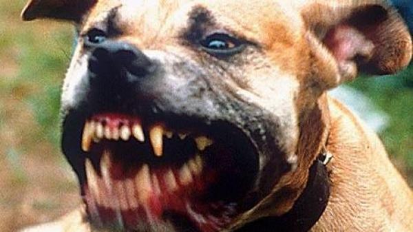 كلب من فصيلة شرسة يهاجم طفلا ويرسله في حالة خطيرة للمستعجلات وظاهرة تربية "البيتبول" تعود للواجهة