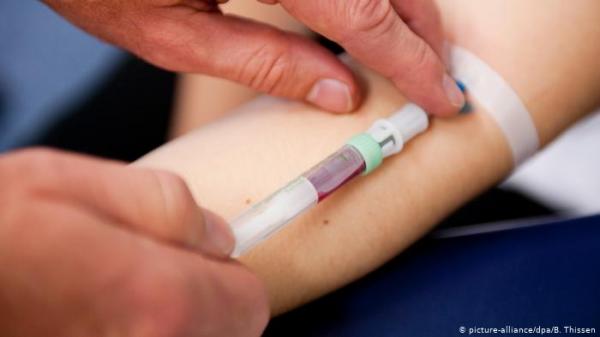 اختبار دم يتنبأ بمرض الزهايمر قبل ظهوره بـ 20 سنة