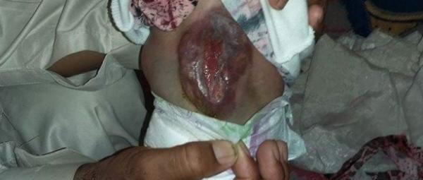 من مراكش : الرضيعة " إيمان " في وضع صحي خطير تناشد أصحاب القلوب الرحيمة (الفيديو)
