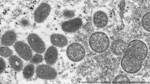 باحثون برتغاليون ينشرون جينوم فيروس جدري القرود