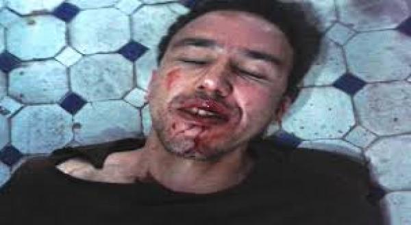 الإعتداء على الصحفي هشام منصوري من طرف مجهولين