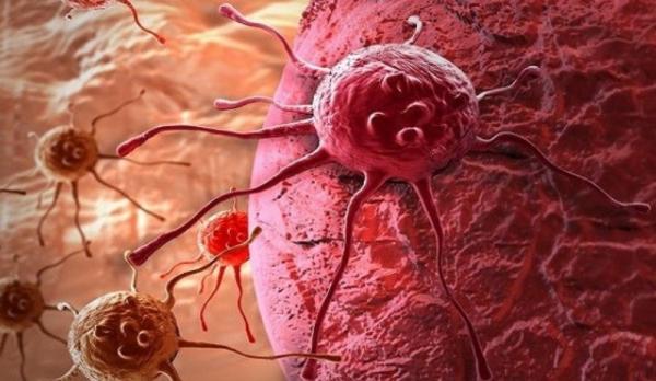 علماء يتوصلون الى سر نمو الأورام السرطانية وانتشارها