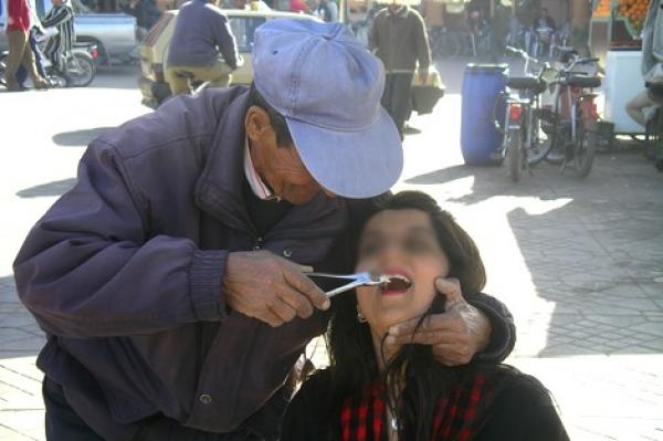 صناع الأسنان يتهمون البيجيدي ب"تجييش" برلمانييه لفرض مشروع قانون يقضي عليهم