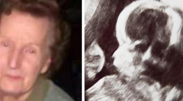 امرأة حامل ترى وجه جدتها في صورة جنينها