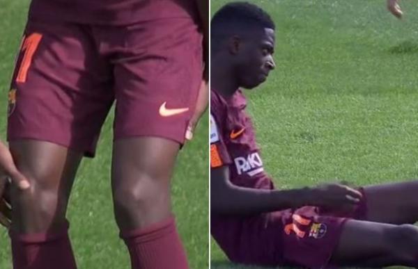 برشلونة يكشف طبيعة اصابة عثمان ديمبلي في مباراة خيتافي (فيديو)