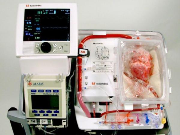 جراحة «القلب الميت».. إنجاز طبي يقلب موازين زراعة الأعضاء