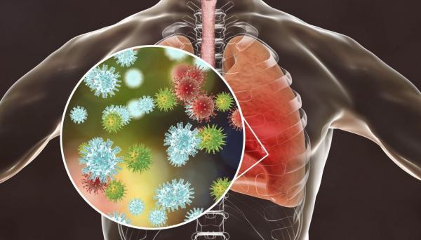 علماء يطورون علاجا قد يقتل 99.9% من فيروسات كورونا في الرئتين