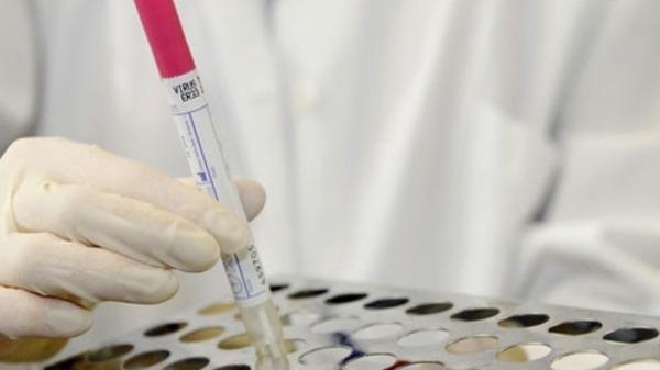 خمس حالات وفاة جديدة بفيروس كورونا في السعودية