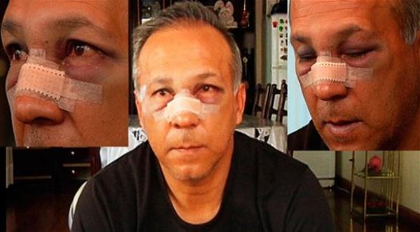 لاعب بوليفي يعتدي على مدربه بالركل في الوجه و يصيبه بكسر في الأنف