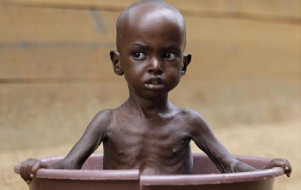 نداءات دولية مستمرة لمواجهة أزمة المجاعة بمنطقة القرن الإفريقي 