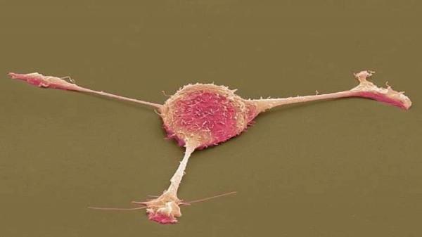 فيروس معدل وراثيا يقتل الخلايا السرطانية ويدمر مخابئها