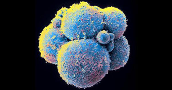 علماء ينجحون في تخليق "أدمغة بشرية صغيرة" من خلايا جذعية