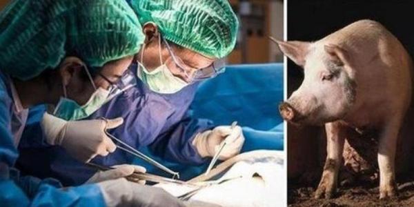 بعد القلب: زرع كلية خنزير في جسد إنسان لأول مرة