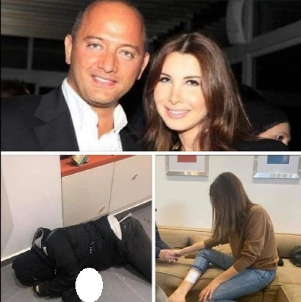 إصابة فادي الهاشم زوج نانسي عجرم وتؤجل حفلها فيديو مجلة الجرس