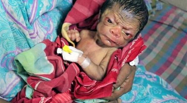 بالفيديو والصور: طفل حديث الولادة بملامح ثمانيني