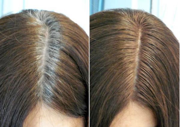 8علاجات منزلية لمنع ظهور الشعر الأبيض