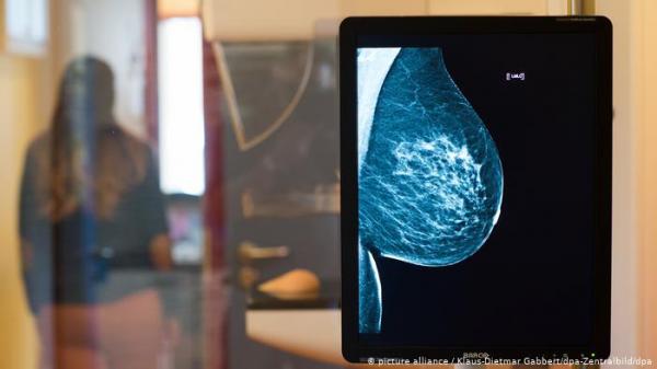 أمل جديد لمريضات سرطان الثدي بتحويل الخلايا المصابة إلى دهون