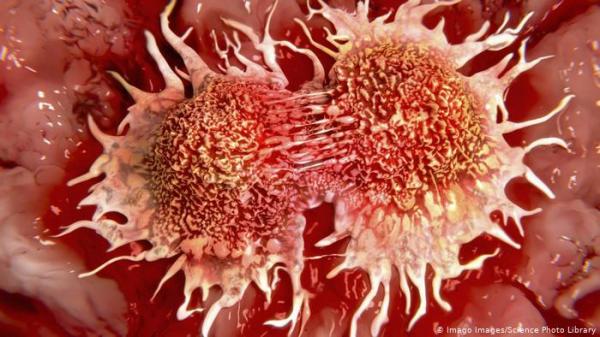 أطباء سيعتمدون على فحص الدم لرصد الأورام السرطانية في وقت مبكر