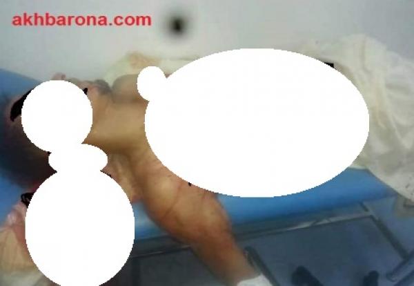صورة الضحية بعد نقله للمستشفى