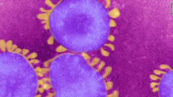 العلماء يعثرون على فيروس جديد للإيدز