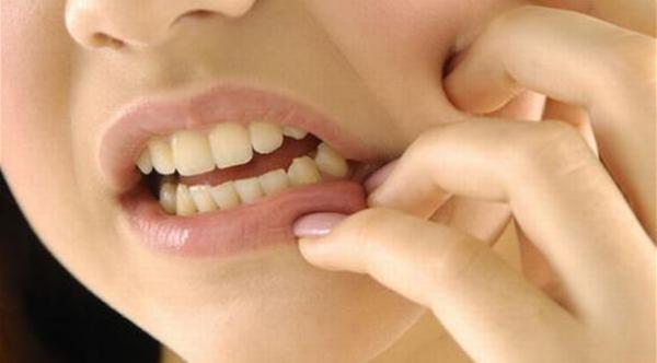 9 أخطاء يومية تضر الأسنان
