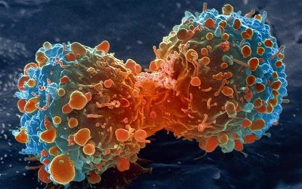 إنتبهوا: أربع أنواع من السرطان تقف وراءها سلوكيات معيشية