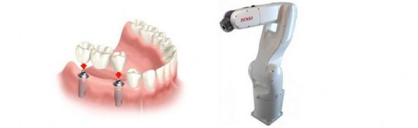 وداعا لفرشاة الأسنان:علماء يطورون روبوتات دقيقة لتنظيف وشفط الاسنان!