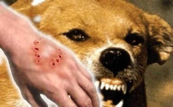 حوالي 20 حالة وفاة بداء الكلب وأزيد من 300 إصابة بين الحيوانات سنويا بالمغرب
