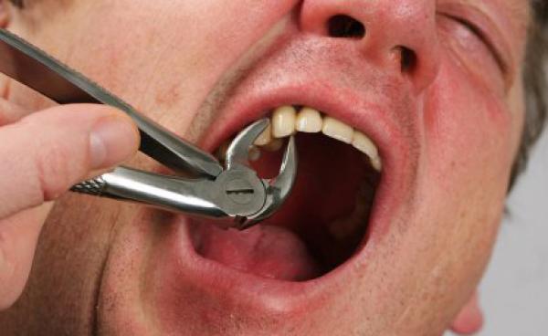 خطر حقيقي يهدد صحة المغاربة بسبب "أطباء الأسنان" المزيفين