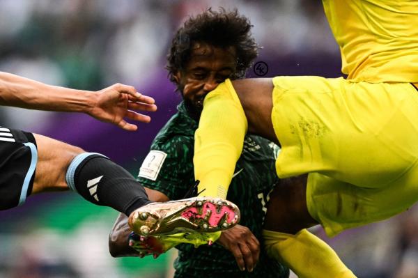 عملية جراحية جديدة للاعب السعودي "الشهراني" بعد الإصطدام الخطير مع زميله خلال مباراة الأرجنتين