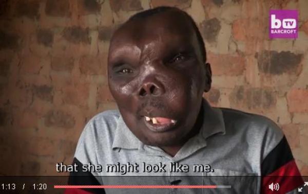 بالفيديو: صاحب أغرب رأس في أوغندا يتحول لنجم غنائي