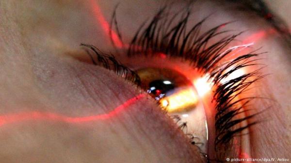 الجراحة الليزرية لتغيير لون العين بحاجة للمزيد من الدراسة