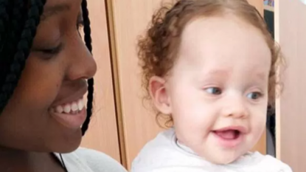 بالفيديو: امرأة سوداء تنجب طفلة بيضاء بعيون زرقاء