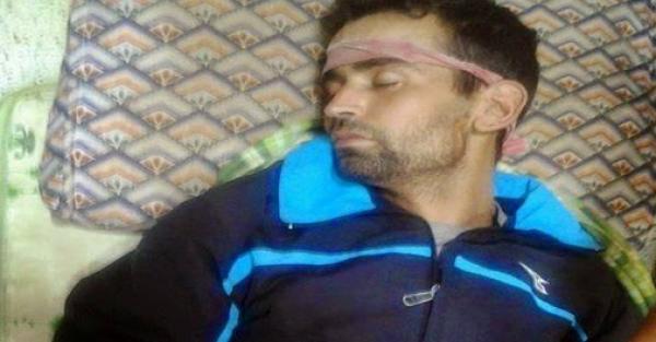 فــاس: معتقل مضرب عن الطعام يفقد بصره و يعيش حالة إحتضار