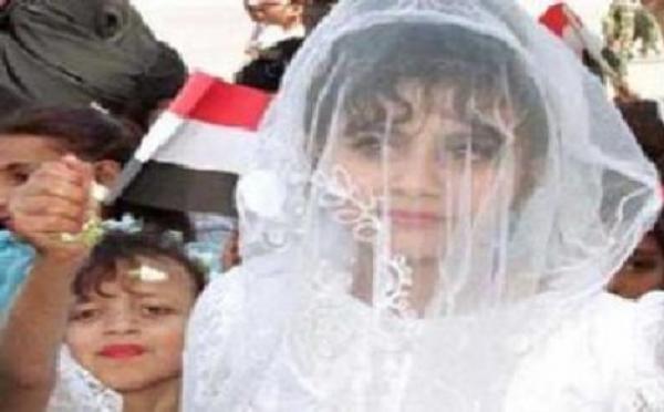 وفاة طفلة يمنية عمرها 8 سنوات في &#039;ليلة دخلتها&#039; على رجل أربعيني 