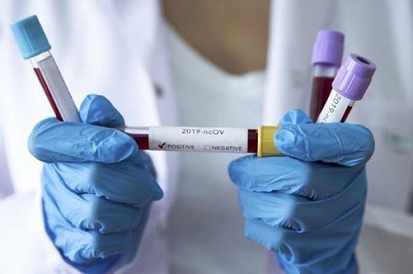 في غفلة من وزارة الصحة، مختبر خاص يجري أزيد من 20 ألف اختبار لكورونا دون ترخيص