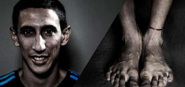 صحيفة إسبانية تنشر صور “أقبح أقدام في عالم كرة القدم”