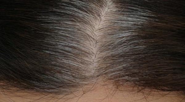 أسباب تساهم في فقدان لون الشعر في سن مبكرة