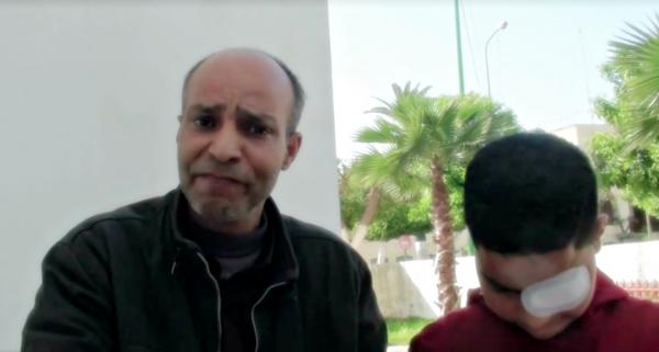 بالفيديو : أب يبكي بحرقة بعد أن فقأ " ولد الفشوش " عين إبنه و " المخزن " رفض الاستماع إليه