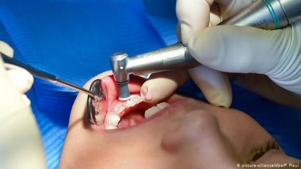 "الأسنان الطباشيرية".. مرض يصيب الأطفال ويحير الأطباء