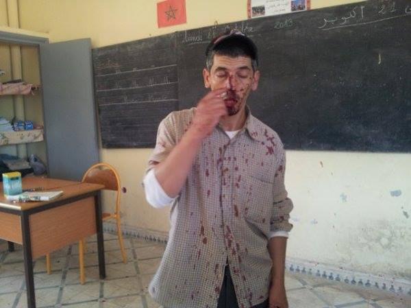 أستاذ يتعرض لاعتداء شنيع من طرف أب أحد التلاميذ إقليم سيدي سليمان