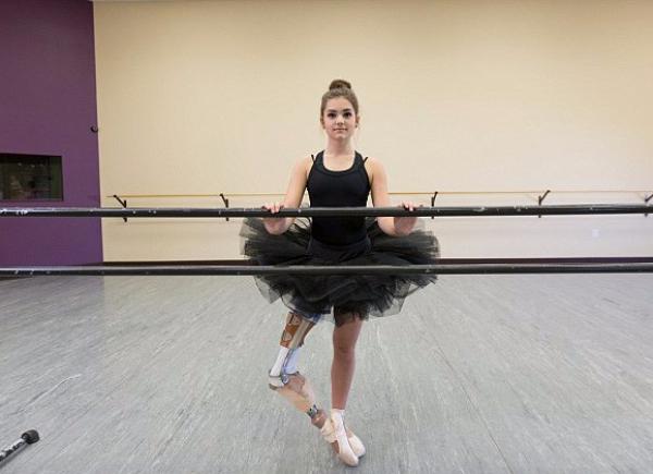 بعد بتر ساقها .. طفلة أمريكية تتحدى الإعاقة لتصبح أشهر راقصة بالية ( صور )
