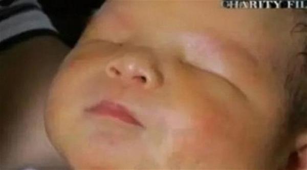 بالفيديو: صينية تنجب طفلاً بلا عينين