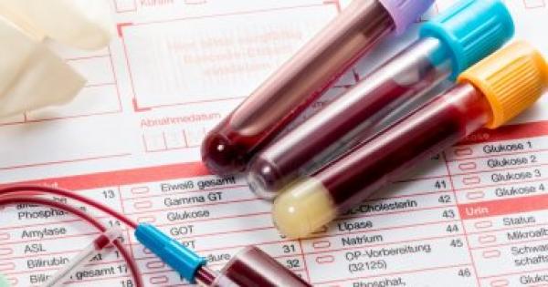 تحليل الفوسفور في الدم ..ما هي أهميته وكيف يمكن تحليل نتائجه؟